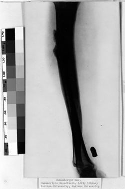 Photograph of x-ray of limb with bullet in it