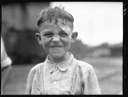 Boy with Frank Avery, at Martinsville depot, bandaged eye