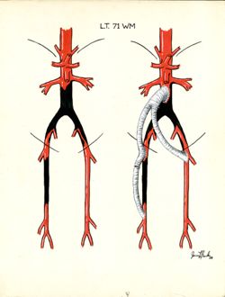 Vascular Surgery Drawings Collection, 1963-1964